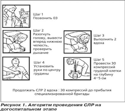 Сердечно-легочная реанимация (СЛР): алгоритм 2021